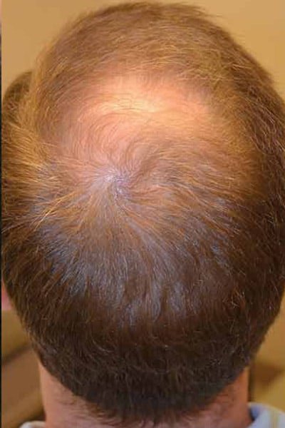 Cabello masculino - vista superior